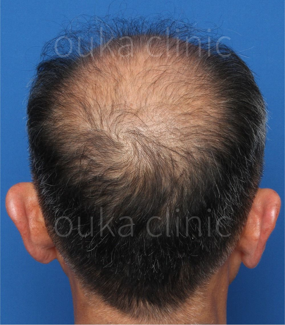 全体の治療前の画像